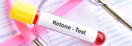 בדיקת קטונים (Ketons) - תמונה